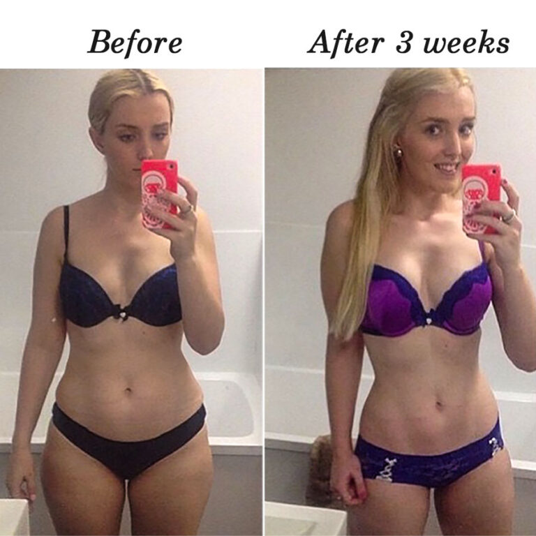 Weight Loss Before and after Inspiration