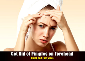 How to get rid of Bumps on Forehead