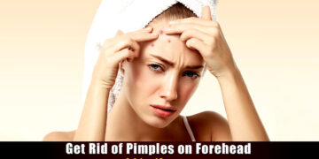 How to get rid of Bumps on Forehead